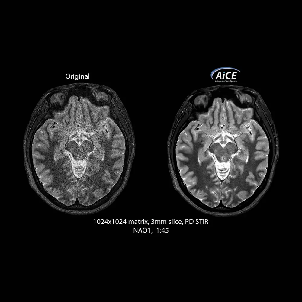 AiCE RM - immagine 2
